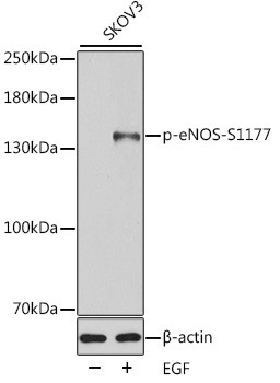 Anti-phospho-eNOS-S1177