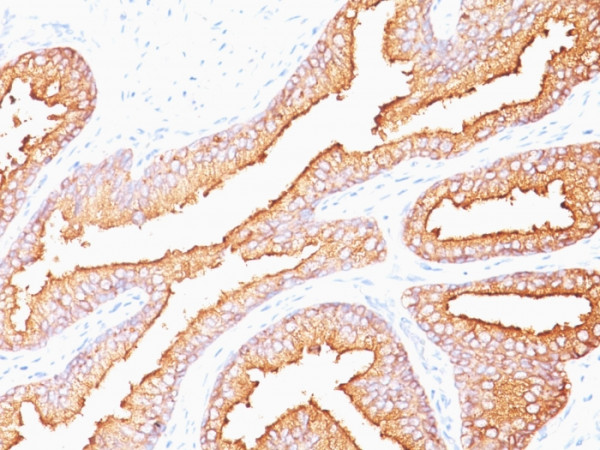 Anti-Prostate Specific Antigen (PSA), clone SPM352