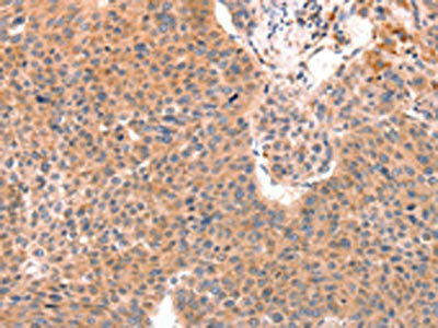 Anti-DAZ4