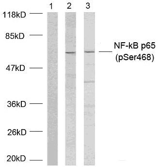 Anti-phospho-NFkB p65 (Ser468)