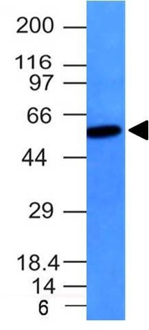 Anti-Vimentin(VM452), CF594 conjugate, 0.1mg/mL