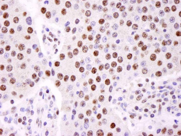 Anti-hnRNP-K (IHC)