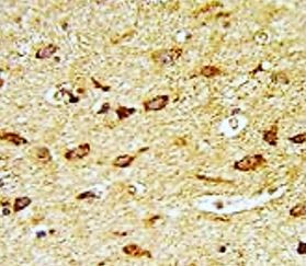 Anti-H Cadherin