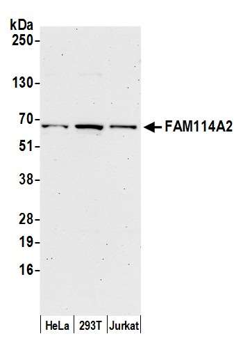 Anti-FAM114A2