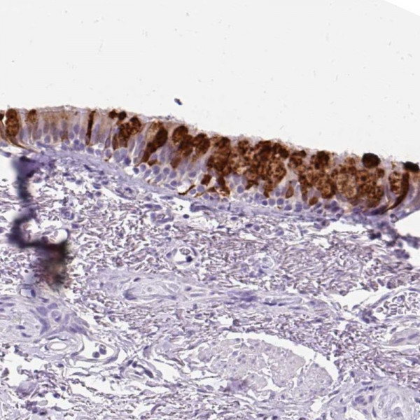 Anti-SCGB1A1
