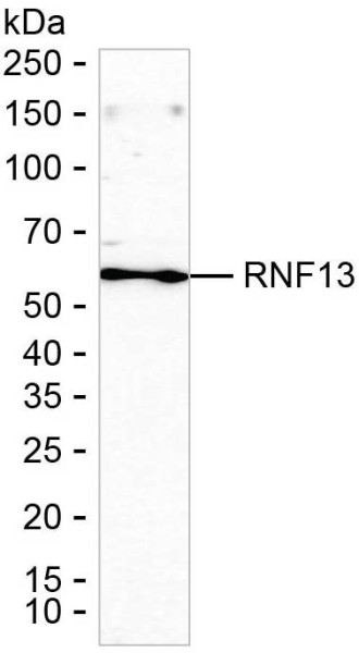 Anti-RNF13