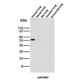 Anti-Alpha 1 Antitrypsin / AAT / SERPINA1, clone AAT/4487