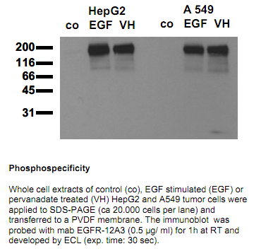 Anti-phospho-EGF-Receptor (Tyr845), clone 12A3