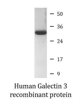 Human Galectin 3 recombinant protein (Active)