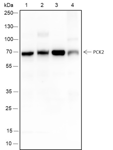 Anti-Recombinant PCK2, clone A324