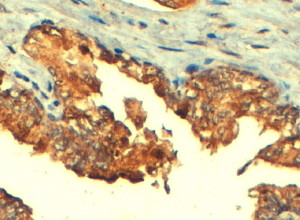 Anti-ABCC4 / MRP4, C-terminal