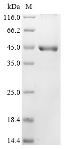 DNA fragmentation factor subunit beta (DFFB), human, recombinant