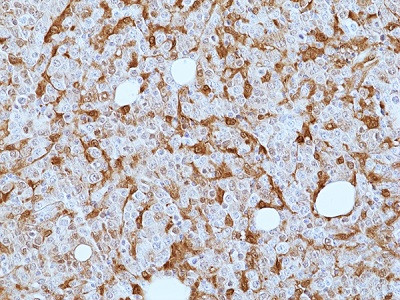 Anti-Galectin-9 (human), Rabbit Monoclonal (RM499)
