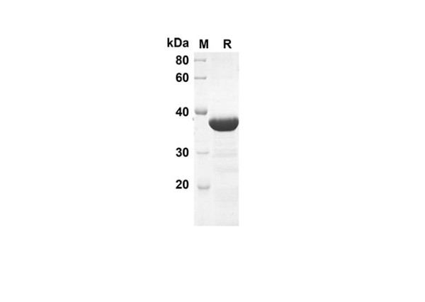 Recombinant Mouse SHH Protein(Trx Tag)
