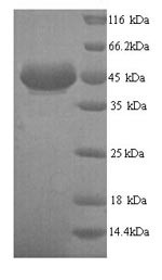 All-trans-retinol dehydrogenase [NAD (+)] ADH7 (ADH7), human, recombinant