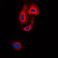 Anti-VASP