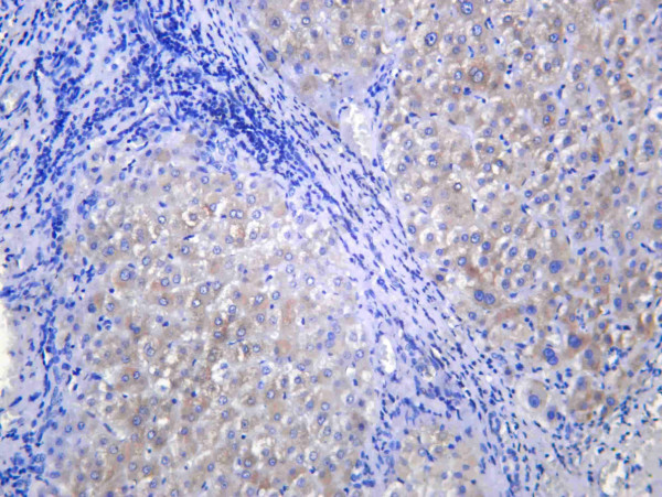 Anti-Recombinant CYP2C19, clone C112575