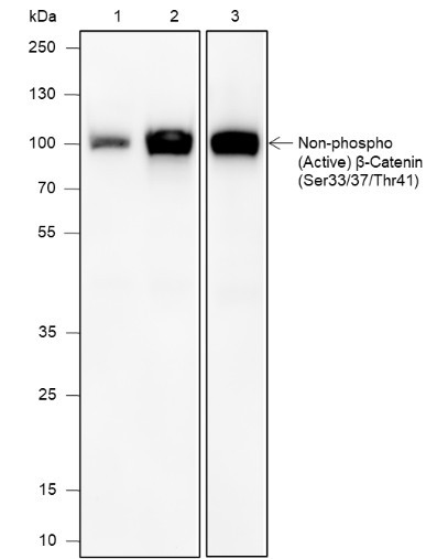Anti-Recombinant Non-Phospho (Active) beta-Catenin (Ser33, Ser37, Thr41), clone A593