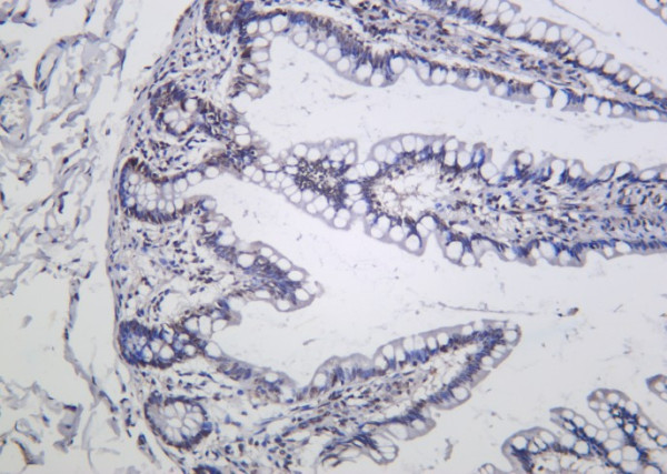 Anti-Recombinant Phospho-IkappaB-alpha (Ser36), clone 9B2