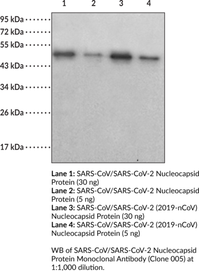 Anti-SARS-CoV/SARS-CoV-2 Nucleocapsid Protein (Clone 005)