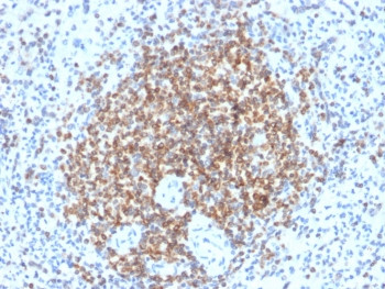 Anti-Bcl-2, clone BCL2/2210R
