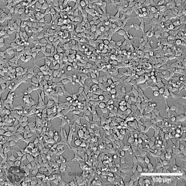 HEK293-CCR8 Cells