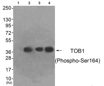 Anti-Phospho-TOB1 (Ser164)