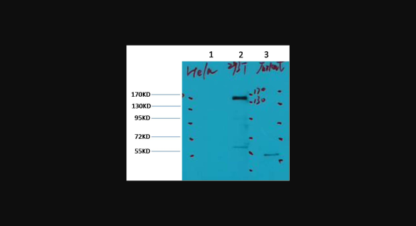 Anti-ErbB-2/HER-2, monoclonal