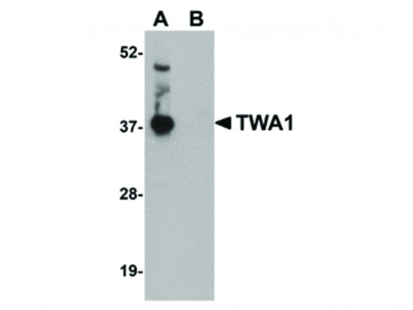 Anti-TWA1