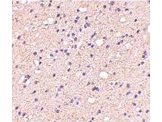 Anti-ELOVL6 (Elongation of Very Long Chain Fatty Acids Protein 6)