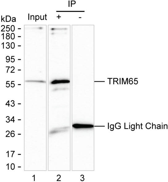 Anti-TRIM65 Magnetic Beads