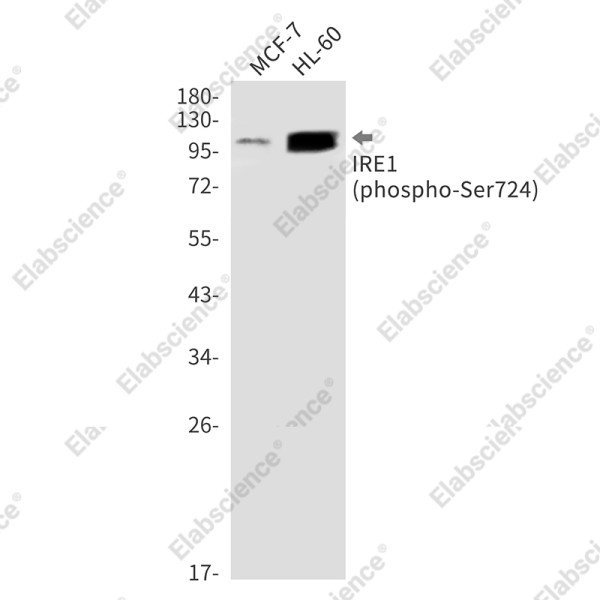 Anti-Recombinant Phospho-IRE1 (Ser724), clone C333014