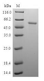 Pyridoxal kinase (PDXK), human, recombinant