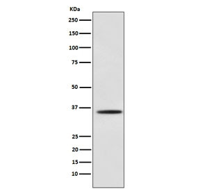 Anti-Myogenin / MYOG, clone AFFH-13