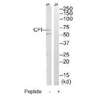 Anti-CFI