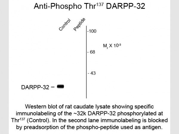 Anti-phospho-DARPP-32 (Ser137)