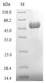 Serine/threonine-protein kinase ATG1 (ATG1), partial, Candida glabrata, recombinant