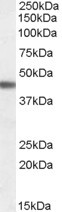 Anti-ADRB3
