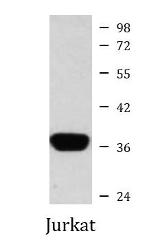 Anti-AKR1B1, clone 4G9-B6-F6