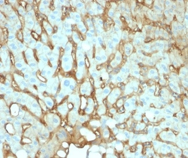 Anti-Albumin (Transport Protein), clone ALB/2141