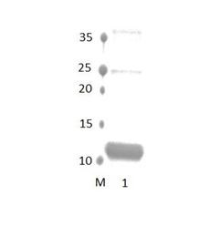 SYNPO2L PDZ Domain