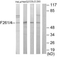 Anti-PFKFB1/PFKFB4