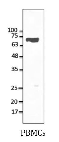 Anti-CD5