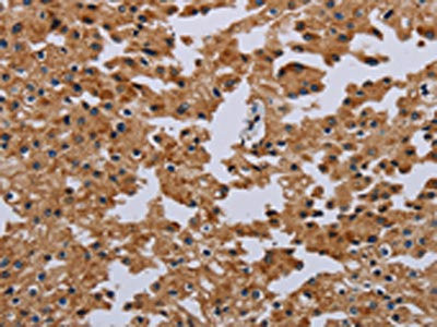 Anti-IFRD1