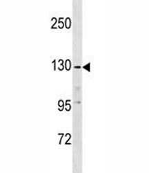Anti-EGF / Epidermal Growth Factor