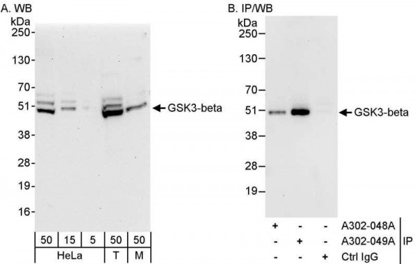 Anti-GSK3-beta