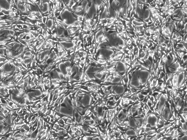 Colon-26 Cells