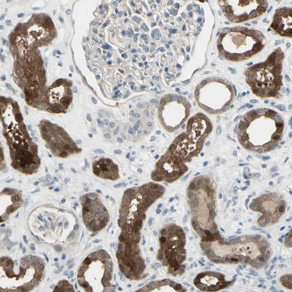 Anti-ETNK1