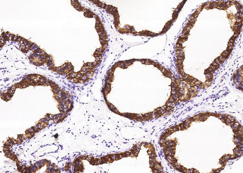 Anti-NPC2 Monoclonal Recombinant Antibody