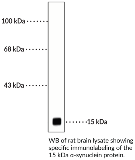 Anti-alpha-Synuclein